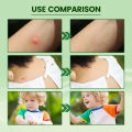 South Moon Anti Mosquito Cream Prevent Insect Bites Relieve Itching Antibacterial Baby Adult Cooling Mosquito Repellent Ointment. 