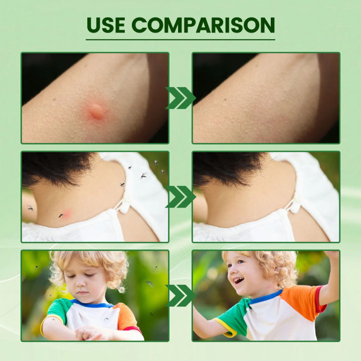 South%20Moon%20Anti%20Mosquito%20Cream%20Prevent%20Insect%20Bites%20Relieve%20Itching%20Antibacterial%20Baby%20Adult%20Cooling%20Mosquito%20Repellent%20Ointment%20-%20Image%205