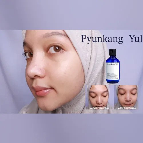 Pyunkang%20Yul%20Essence%20Toner%20%E2%80%93%2030ml%20-%20Image%204