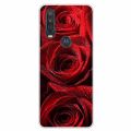 For Motorola One Action Case Painted Cat Soft TPU Silicone Lovely Funda for Moto One Vision Macro Cover Shockproof Phone Para.