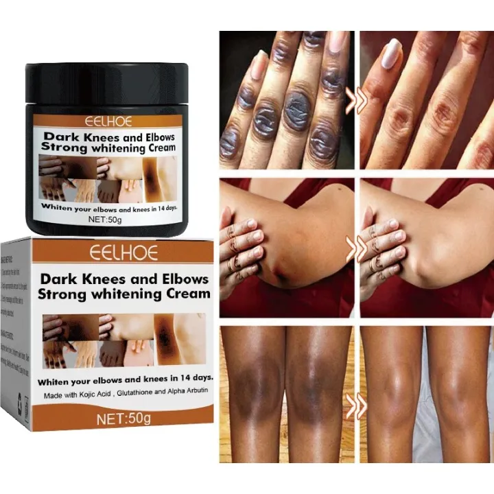 Dark%20s%20Fast%20Whitening%20Cream%20Pigmentation%20Correctors%20For%20Black%20Skin%20Hand%20Elbows%20Knee%20Intense%20Stains%20Remover%20Cream%20-%20Image%202