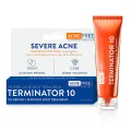 AcneFree Terminator 10 Acne Spot Treatment with Benzoyl Peroxide 10% Maximum Strength Acne Cream Treatment, 30mL. 