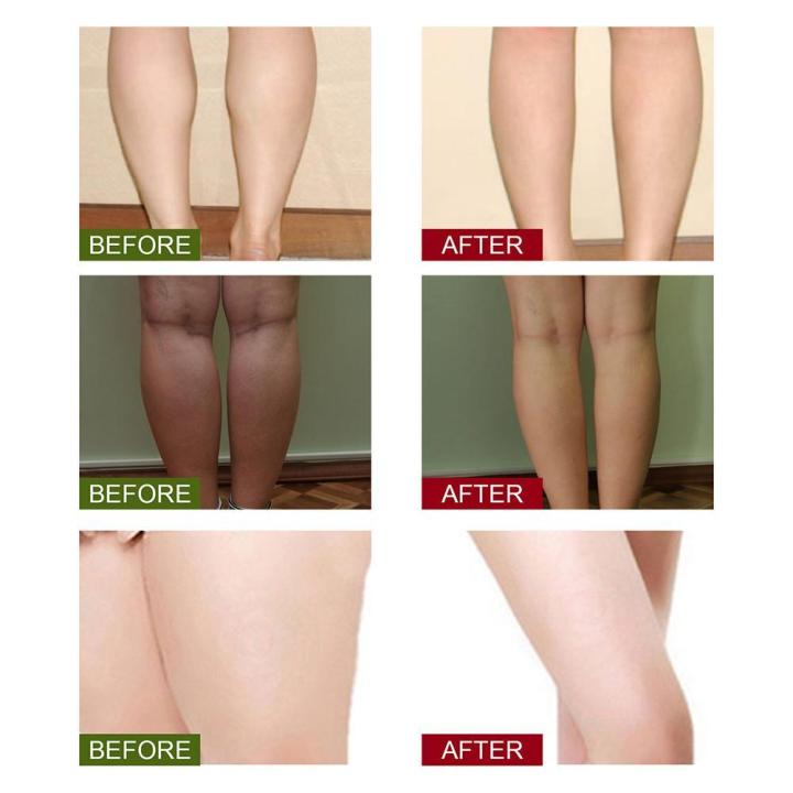 10/20/30/50pcs%20Leg%20Slimming%20Foot%20Bath%20Lympatic%20Drainage%20Ginger%20Foot%20Soak%20Ginger%20Foot%20Bath%20Powder%20SPA%20Dropship%20Products%20-%20Image%204