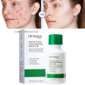 BIOAQUA Salicylic Acid Shrink Pores Face Serum Oil Control Remove Acne Blackheads Dark Spot Whitening Moisturizing Skin Care Essence -35ML. 