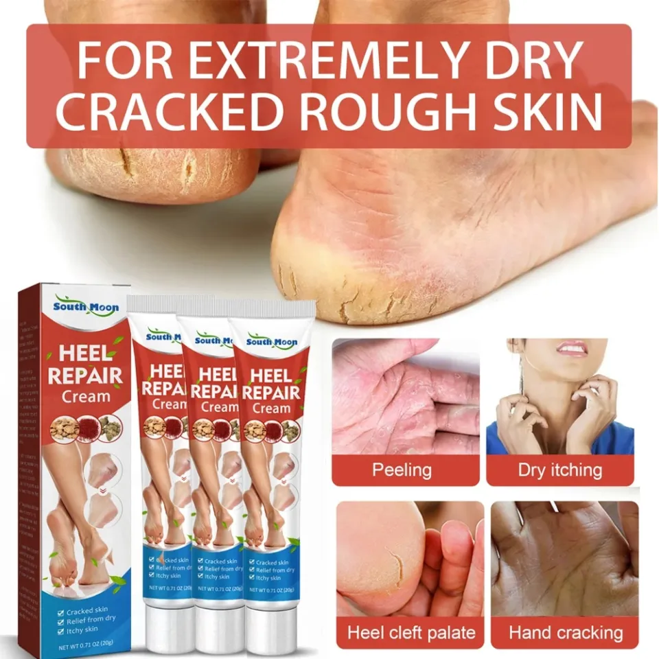 Heel Repair Cream Pedicure Cracked Foot Care Leg Toe Nail Heels