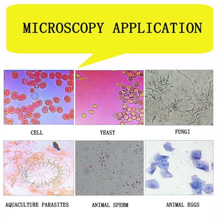 Professional%20live%20blood%20cells%20analysis%20Laboratory%20biological%20HD%20Microscope%20TV%20AV%20USB%20with%20Electronic%20Eyepiece%207/9/10.1-inch%20LCD%20-%20Image%203