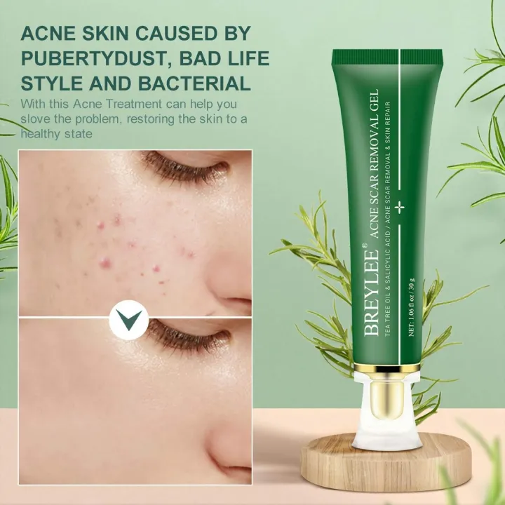 Breylee%20Acne%20&%20Scar%20Removal%20Gel%20-%2030g%20-%20Image%206