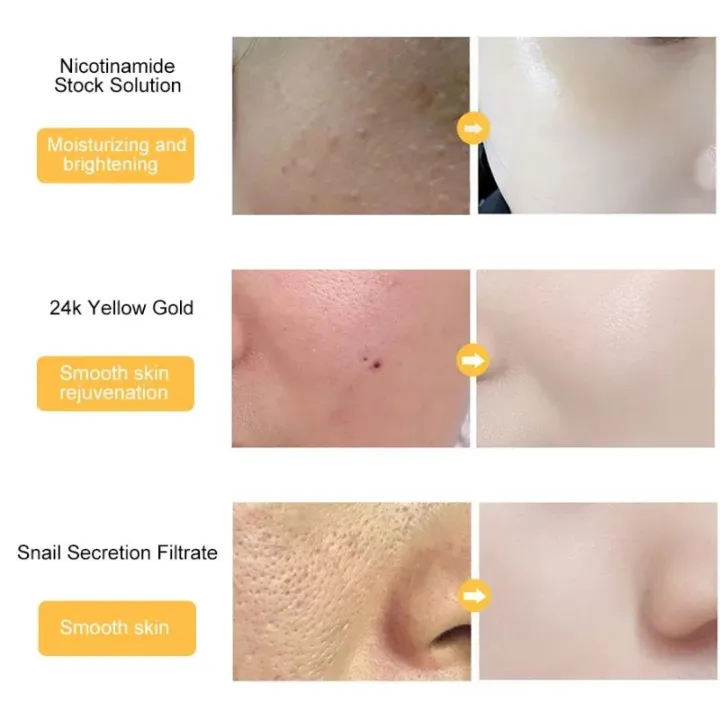 30-100ML%2024K%20Gold%20Facail%20Essence%20Oil%20Hyaluronic%20Acid%20Acne%20Moisturizer%20Serum%20Whitening%20Day%20Creams%20Anti%20Aging%20Wrinkle%20Skin%20Care%20-%20Image%203