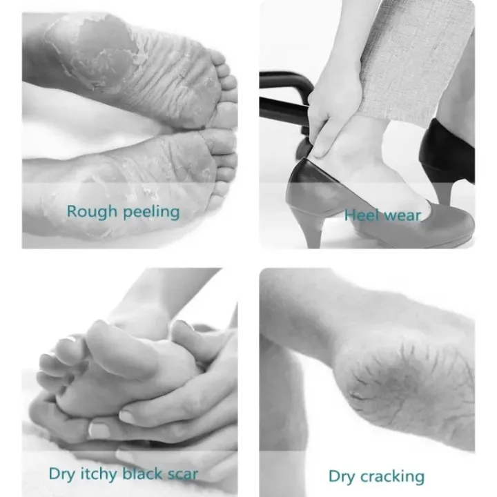 Foot%20Cream%20Stick%20Anti-Blister%20Foot%20Protection%20Heel%20Care%20Balm%20Stick%20moisturizing%20repairing%20preventing%20foot%20abrasion%20relive%20pains%20-%20Image%202