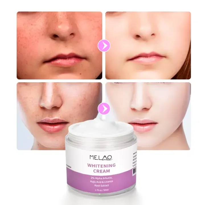 Melao%202%25%20Alpha%20Arbutin,%20Kojiac%20Acid%20Whitening%20Cream%20-50%20ml%20-%20Image%203
