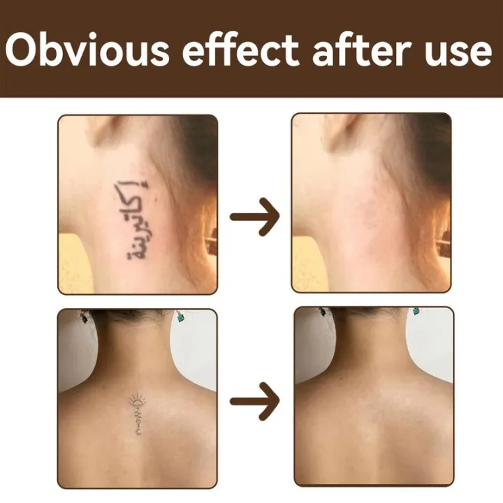 Tattoo%20Cover-Up%20Makeup%20Professional%20Scars%20Tattoo%20Concealer%20Tattoo%20Cover-Up%20Makeup%20Use%20On%20Body%20For%20Legs%20For%20Men%20And%20Women%20-%20Image%205