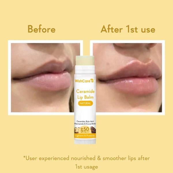 WishCare%20Ceramide%20Lip%20Balm%20with%20SPF%2050%20PA+++%20(Natural)%20-%20Image%203