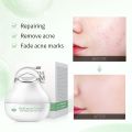 Fenyi Acne & Pimple Spots Stretch Marks Removal Cream - 8g. 