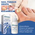 Fungus Nail Serum Repair Toenail Fungal Treatment Essence Anti Infection Drops Paronychia Remove Cuticle Oil Feet Nail Care 30ml. 