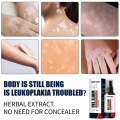 South Moon Vitiligo Treatment Spray Moisturizing Reduces White Spots Leukoplakia Disease Pigment Melanin Repair White Tag Care-30ml. 