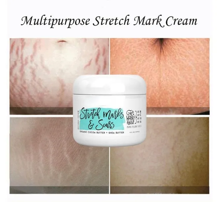 Natural%20Organic%20Postpartum%20Stretch%20Mark%20Removal%20Skin%20Repair%20Cream%20Body%20Pregnancy%20Scar%20Cream%20For%20Women%20-%20Image%204
