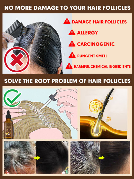 Gray%20Hair%20Treatment%20Serum%20Fast%20White%20To%20Black%20Repair%20Natural%20Color%20Nourish%20KKhao%20-%20Image%205