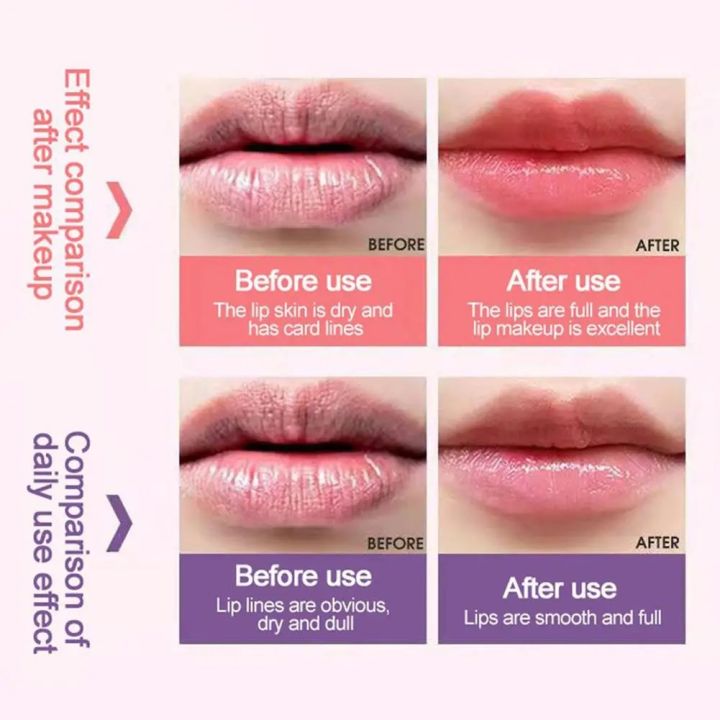 5/3/2/1PCS%20Lip%20Sleeping%20Mask%20Night%20Sleep%20Maintenance%20Moisturizing%20Fade%20Lip%20Lines%20Nourishing%20Lip%20Balm%20Skin%20Care%20Korean%20Cosmetic%20-%20Image%206
