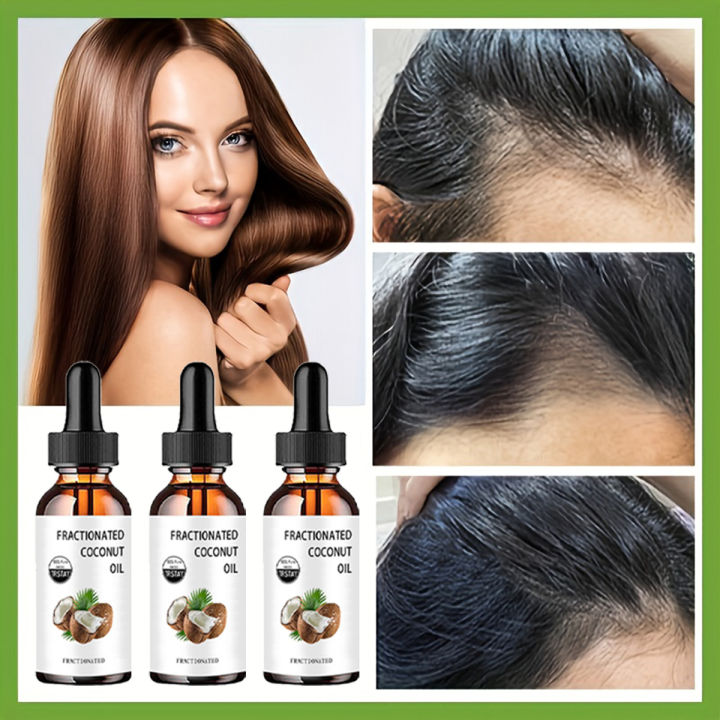 Fractionated%20Coconut%20Oil%20100%25%20pure%20nut%20can%20moisturize,%20soften%20and%20care%20for%20dry%20and%20craed%20skin,%20-%20Image%205