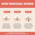 Kirkland Signature Topical Minoxidil 5% Extra Strength for Men Hair Regrowth Treatment - MNXMS.
