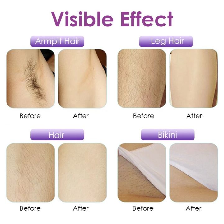 Portable%20Electric%20Roll%20On%20Wax%20Machine%20Can%20Be%20Filled%20With%20Hair%20Removal%20Wax%20Strip%20Hair%20Remover%20Roller%20Waxing%20Heater%20Machine%20-%20Image%204