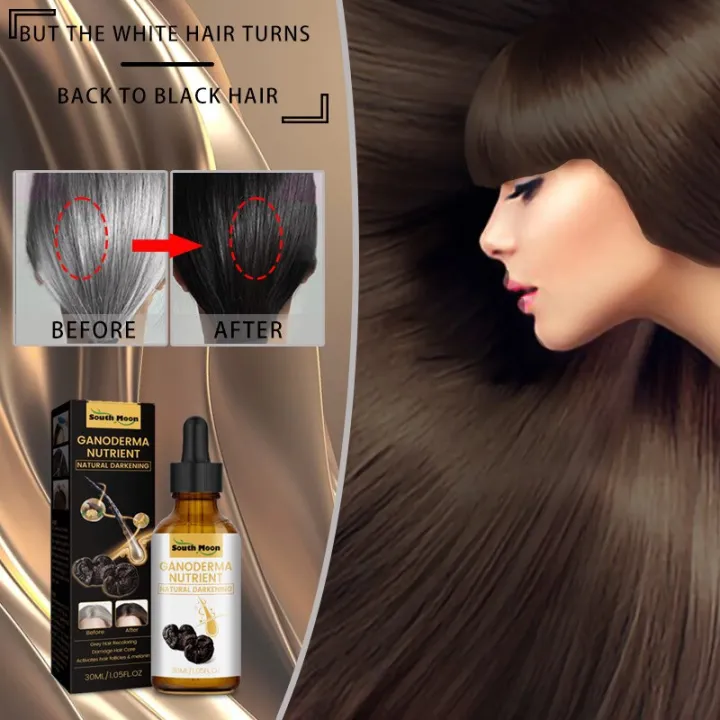 10PCS%20Gray%20White%20Hair%20Treatment%20Serum%20Liquid%20White%20To%20Black%20Natural%20Color%20Repair%20Nourish%20Product%20Anti%20Loss%20Hair%20Care%20Men%20Women%20-%20Image%202