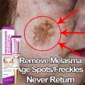 Melasma Remover Cream Removal Dark Pigment Brighten Cream Face Fade Melanin Cream Nicotinamide Brightening Moisturizing Emulsion.