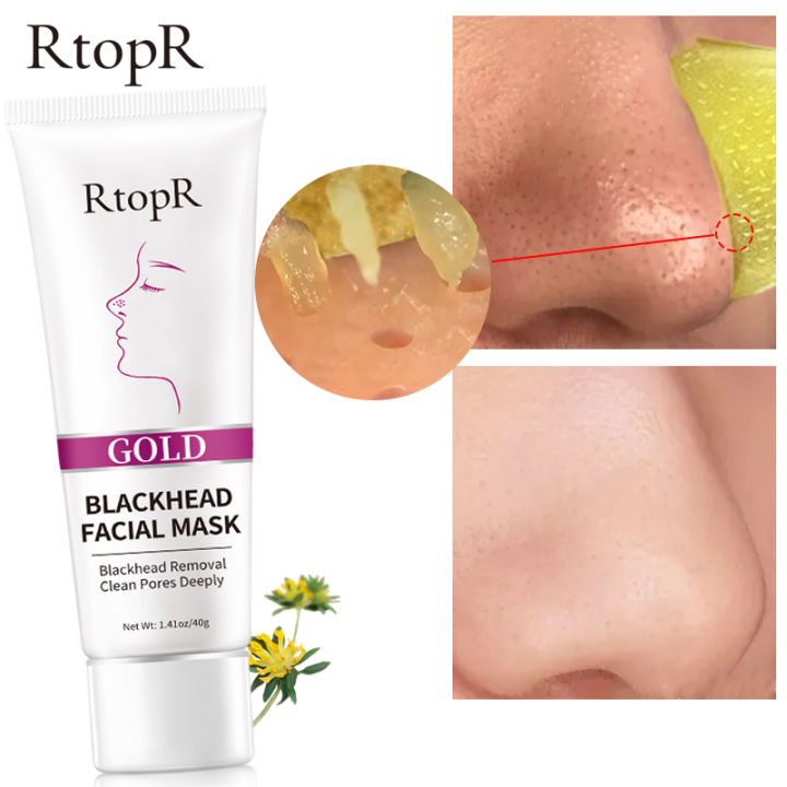 RtopR%20Gold%20Remove%20Blackhead%20Face%20Mask%20Pore%20Peeling%20Acne%20Treatment%20Nose%20Deep%20Cleansing%20Face%20Mask%20Whitening%20Hydrating%20Golden%20Mud%20-%20Image%203