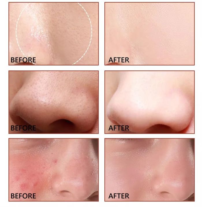 Vibrant%20Glamour%20Shrink%20Pores%20Pore%20Minimize%20Serum-%2030ml%20-%20Image%203