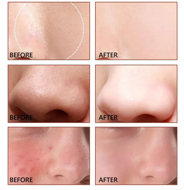 Vibrant%20Glamour%20Shrink%20Pores%20Pore%20Minimize%20Serum-%2030ml%20-%20Image%203