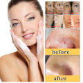 Kojic Acid Skin Care Set Facial Cleanser Body Lotion Handmade Soap Remove Dark Spots Whitening Anti Aging Remove Acne Body Care.