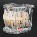 Pathology Model With Missing Tooth Tooth-tooth For Dental Experimental. 