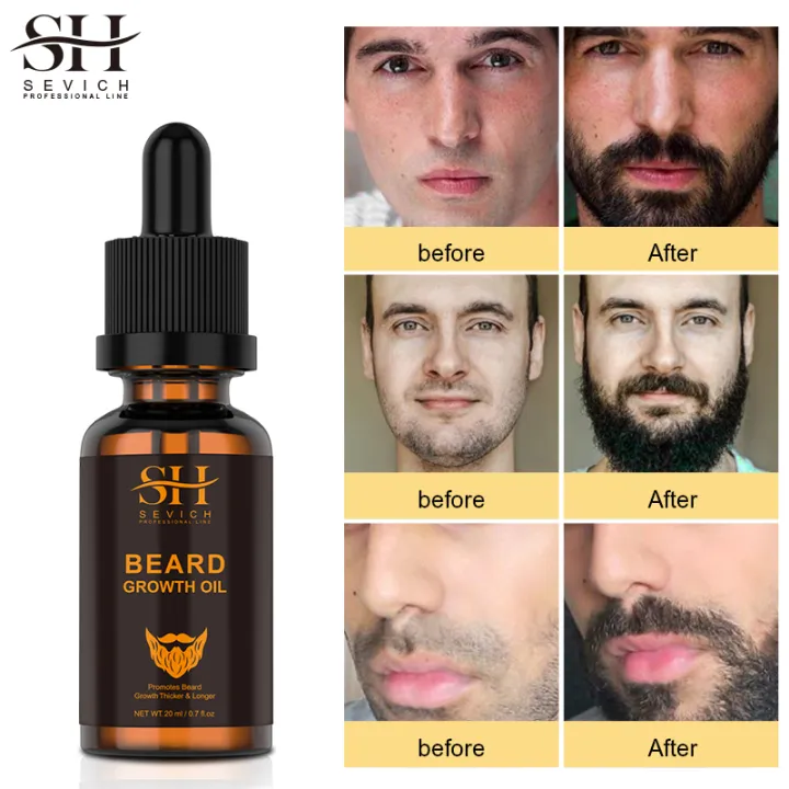 SEVICH%20Beard%20Growth%20Essence%20Natural%20Nutrition%20Men's%20Beard-20ml%20-%20Image%202