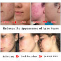 Kojic Acid Skin Care Set Facial Cleanser Body Lotion Handmade Soap Remove Dark Spots Whitening Anti Aging Remove Acne Body Care.