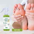 Foot Peeling Spray Whiten Foot Natural Orange Essence Pedicure Hands Dead Skin Exfoliator Exfoliating Care Tool Japan Cosmetics. 