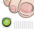 10Pieces Ingrown Toenail Corrector Strips Toenail Correction Tool Men. 