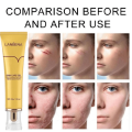 LanBeNa - TCM SCAR AND ACNE MARK REMOVAL GEL OINTMENT (30g) Acne Scar Cream. 