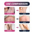 EELHOE Hair Removal Cream Series Painless Hair Remover Mild Non Irritating Permanent Hair Removal for Men Women Depilatory Cream. 
