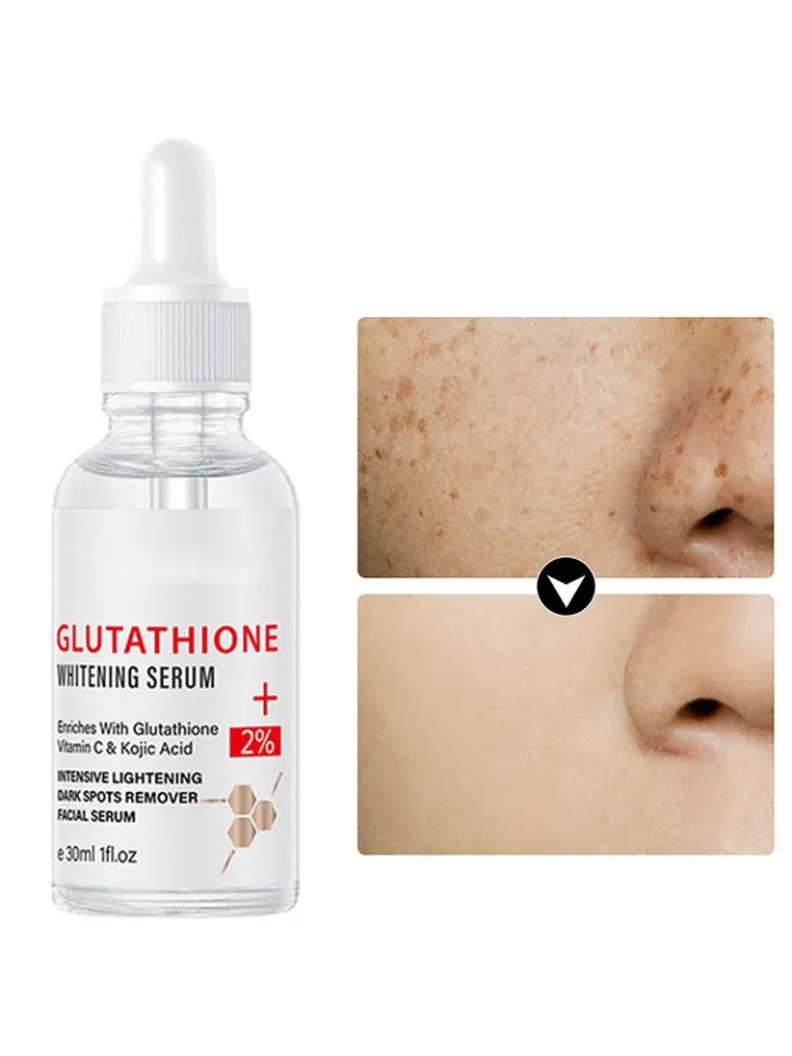 Glutathione Serum Remove Melasma Dark Dilute Serum With Acid Moisturizing  Essence Vitamin Face Kojic Whitening V2j9 | Daraz.com.bd