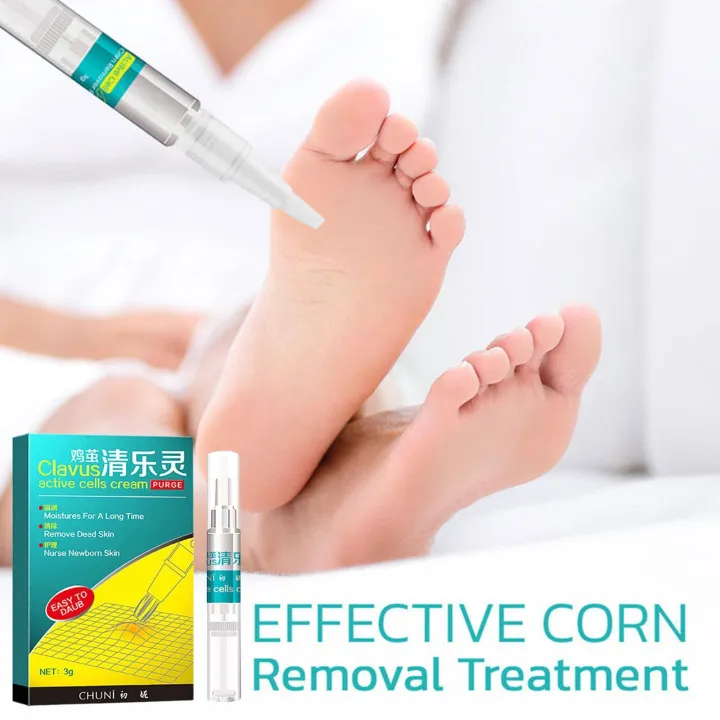 Foot%20Corn%20Removal%20Pen,%20Corn/callus%20Remover%20Liquid,%20Treatment%20Foot%20Genital%20Tag%20Care%20Skin%20Corn%20Skin%20Moles%20Remover%20Wart%20Remo%20G6x0%20-%20Image%202
