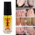 Tuojia Essential Oil Removal Of Onychomycosis Care Fungal Nail Toe Oil Infection Anti Paronychia Oil Nail Fungus Tool. 