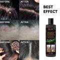 EELHOE 100ml Tinea Dispelling Anti-itching Shampoo Anti-dandruff Shampoo Hair Shampoo Treatment Oil Refreshing Control. 