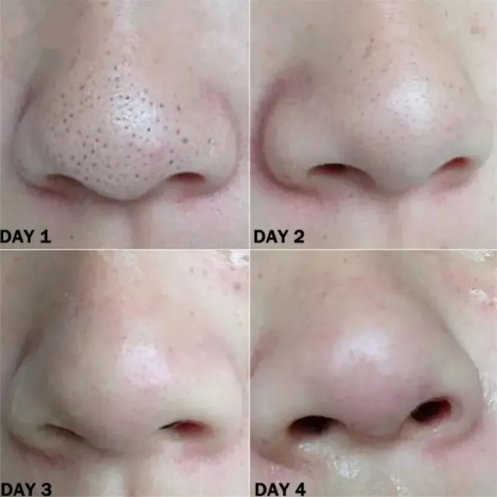 Black%20Peel%20off%20Mask%20Facial%20Blackhead%20Remover%20Mask%20Shrink%20Pores%20Acne%20Black%20Head%20Removal%20Nose%20Cleansing%20Skin%20Care%20-%20Image%205