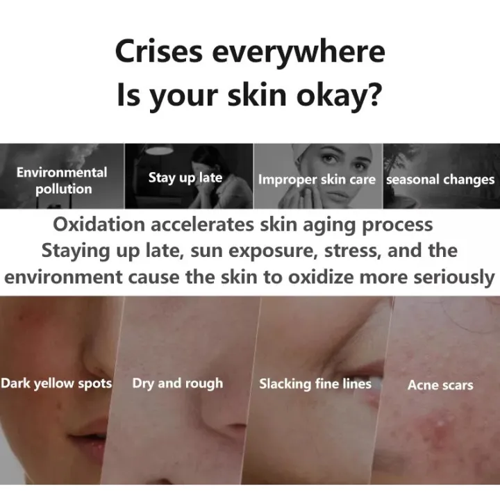 melasma%20and%20pekas%20remover%20serum,Nature%20dark%20spot%20remover%20for%20face,freckle%20remover%20cream%20anti%20aging%20cream%20-%20Image%202