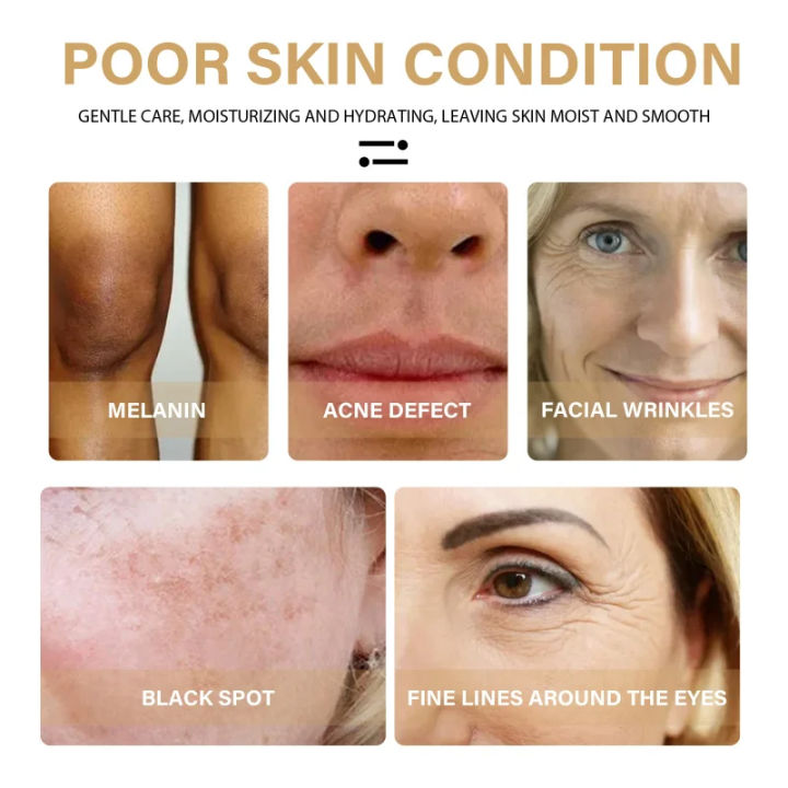 Best%20Retinol%20Serum%20Anti%20Aging%20Skin%20Care%20Serum%20For%20Your%20Skin%20For%20Both%20Men%20and%20Women%20Moisturizer%20Face%20Serum%20-%20Image%205