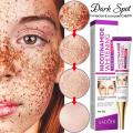Melasma Remover Cream Removal Dark Pigment Brighten Cream Face Fade Melanin Cream Nicotinamide Brightening Moisturizing Emulsion.