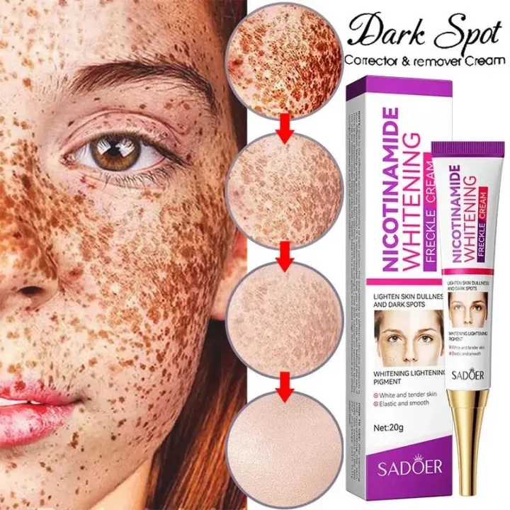 Melasma%20Remover%20Cream%20Removal%20Dark%20Pigment%20Brighten%20Cream%20Face%20Fade%20Melanin%20Cream%20Nicotinamide%20Brightening%20Moisturizing%20Emulsion%20-%20Image%203