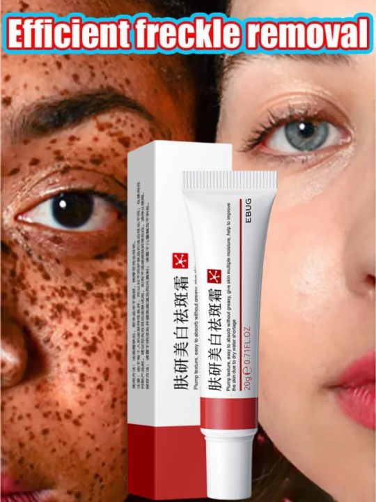 Face Dark Spots Remover for Women Remove Melasma Freckles Cream Removal Melanin Whitening Cream Fade Spots Skin Brightening Care