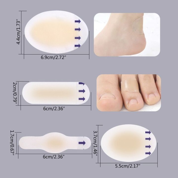 1pc%20Blister%20Bandages,Blister%20Gel%20Pads%20Waterproof%20Hydrocolloid%20Gel%20Blister%20Cushions,Adhesive%20Foot%20Blister%20Patch%20for%20Feet,%20Toe%20-%20Image%204