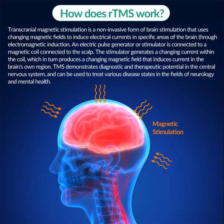 ZJKC%20Transcranial%20Magnetic%20Stimulator%20rTMS%20Brain%20Therapy%20Machine%20Modulate%20Brain%20Activity%20Transcranial%20Stimulation%20Device%20-%20Image%202